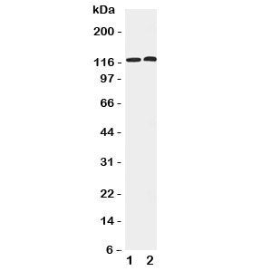 HDAC5 Antibody