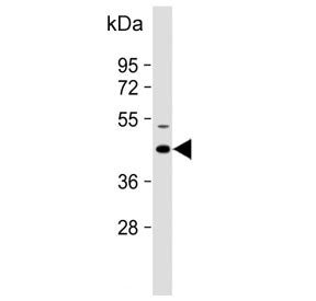 Western blot testing of mouse eyeball lysate with Keratocan antibody. Predicted molecular weight ~41