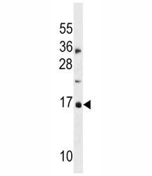 CDKN2A Antibody