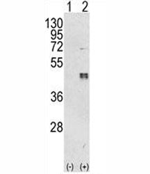 CEBPB Antibody