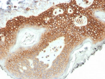 IHC staining of FFPE human colon tissue with Delta 1 Catenin antibody (clone CTNND1/4501) at 2ug/ml 