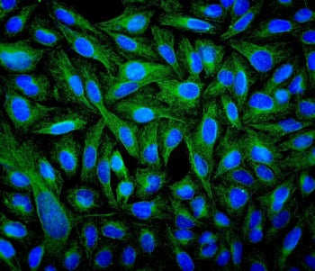 Beta Tubulin Antibody