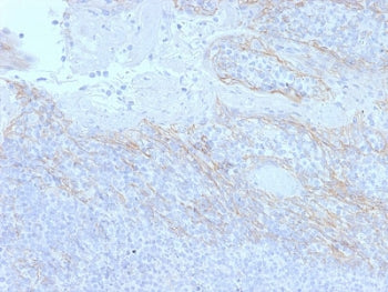 IHC testing of FFPE human tonsil tissue with Beta Catenin antibody (clone CTNNB1/2098). HIER: boil t