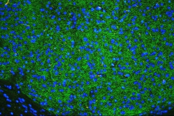 Immunofluorescent staining of FFPE mouse brain tissue with Tyrosine Hydroxylase antibody (green) and