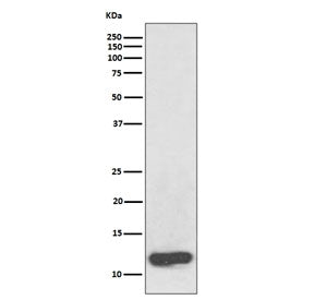 Serum Amyloid A Antibody / SAA1 + SAA2