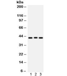 Ataxin 3 Antibody / ATXN3