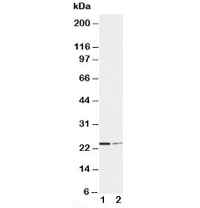 Western blot testing of SOCS1 antibody and Lane 1: HT1080; 2: COLO320 cell lysate. Predicted molecul