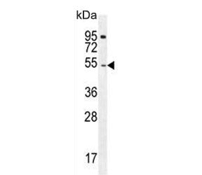 DARS1 Antibody