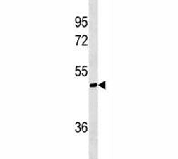 AKT1S1 Antibody / PRAS40