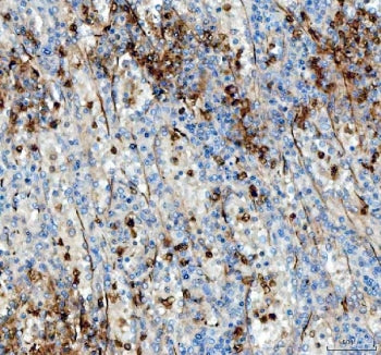 ANGPTL4 Antibody