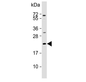 Adrenomedullin antibody / ADM