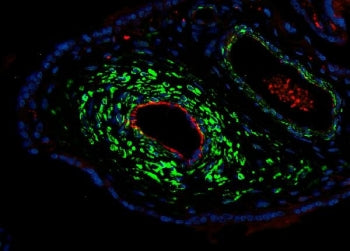 ACTA2 Antibody