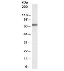 Western blot testing of human kidney lysate with TGFBI antibody at 0.3ug/ml. Predicted molecular wei