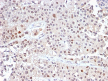 p21 Antibody / CDKN1A