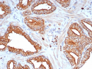 IHC staining of FFPE human prostate tissue with L1TD1 antibody (clone L1TD1/7941). HIER: boil tissue