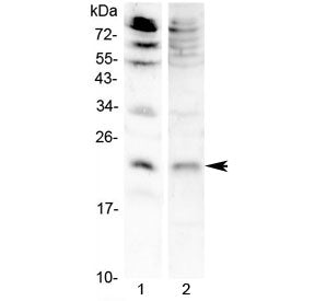 Western blot testing of 1) mouse brain and 2) rat RH35 lysate with FGF7 antibody at 0.5ug/ml. Predic