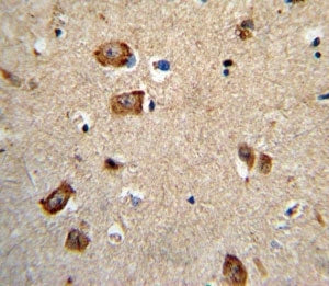 Integrin alpha 1 Antibody (ITGA1)