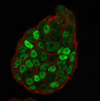 Immunofluorescent staining of PFA-fixed human MCF7 cells with p27Kip1 antibody (clone SX53G8, green)