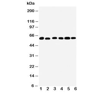 Monoamine Oxidase B Antibody