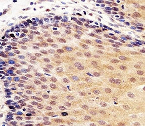 p53 Antibody / TP53, 0.08ml