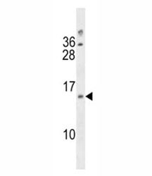 LIMS3 Antibody