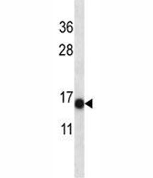 S100A7 Antibody