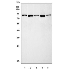 Western blot testing of 1) human HL60, 2) rat brain, 3) rat lung, 4) mouse brain and 5) mouse lung t