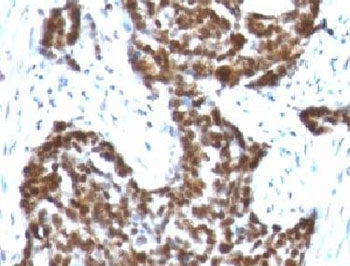 Cyclin B1 Antibody / CCNB1