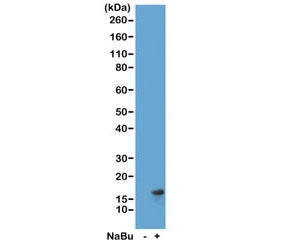 H3K27ac Antibody / Acetyl Histone H3 Lysine 27