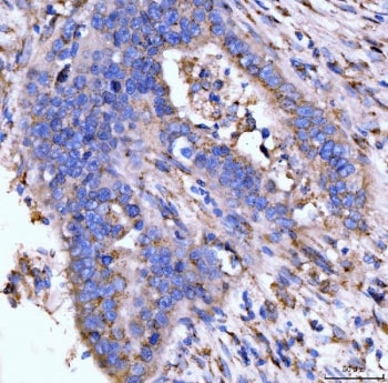 Giantin Antibody / GOLGB1