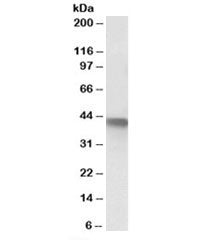 SERPINB1 Antibody