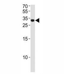 ASCL1 Antibody (MASH1)