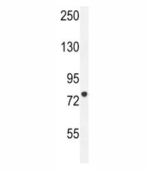 CPT1C Antibody