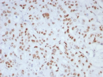 MLH1 Antibody / MutL Homolog 1