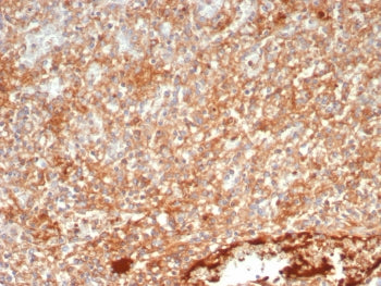SHP-1 Antibody / PTPN6