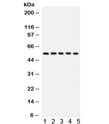 Western blot testing of 1) human placenta, 2) HeLa, 3) A549, 4) MM231, and 5) COLO320 lysate with CR
