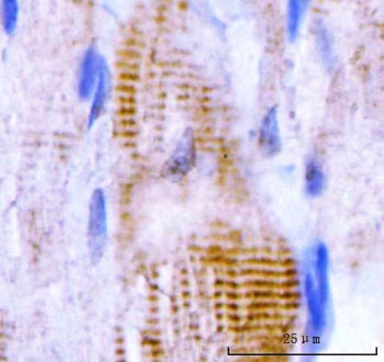 M Cadherin Antibody / CDH15 / CDH14