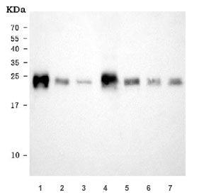 Western blot testing of 1) rat heart, 2) rat liver, 3) rat skeletal muscle, 4) mouse heart, 5) mouse