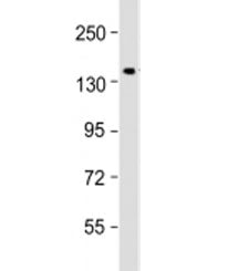 Western blot testing of human kidney lysate with COL4A3 antibody at 1:1000. Predicted molecular weig