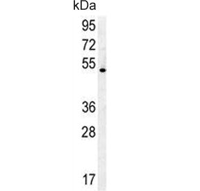 DENND1B Antibody
