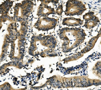 DNAJA2 Antibody