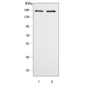 Western blot testing of 1) rat brain and 2) mouse brain tissue lysate with CASPR2 antibody. Predicte