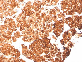 IHC staining of FFPE human pancreas with recombinant Cytokeratin 6A antibody (clone rKRT6A/2100). HI
