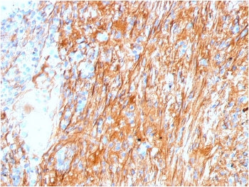 IHC staining of FFPE human lung with Fibronectin antibody (clone FN1/3045). HIER: boil tissue sectio