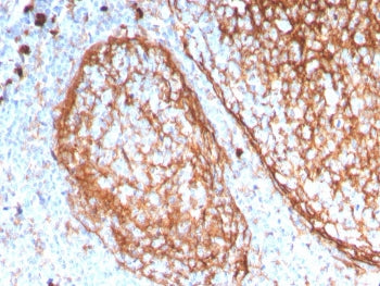 IHC staining of FFPE human tonsil with CD11b antibody (clone ITGAM/3338). HIER: boil tissue sections