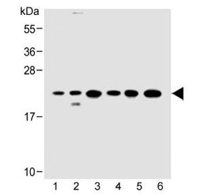 Western blot testing of 1) human HeLa, 2) human 293/T17, 3) mouse C2C12, 4) rat C6, 5) human HT-29 a