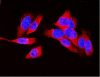 LDHA Antibody / Lactate dehydrogenase A