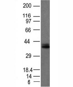 Western blot analysis of HCT116 cell lysate using EpCAM antibody (EGP40/1120). Expected molecular we