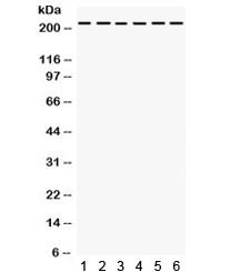 Western blot testing of 1) rat liver, 2) rat kidney, human 3) Jurkat, 4) 22RV1, 5) HepG2, 6) SMMC ly