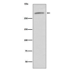 von Willebrand Factor Antibody / vWF
